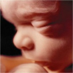 Twenty-week-old unborn child. Twenty-week-old unborn child.