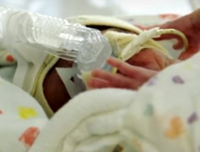 Above, a preemie at Children’s Hospital of Philadelphia; below, illustration of ‘Biobag’ research. Above, a preemie at Children’s Hospital of Philadelphia; below, illustration of ‘Biobag’ research.