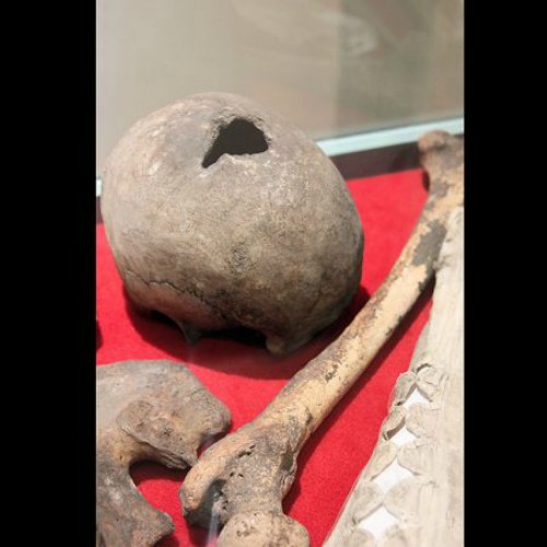 The bones which are believed to belong to English martyr and priest St. John Plessington. The bones which are believed to belong to English martyr and priest St. John Plessington.