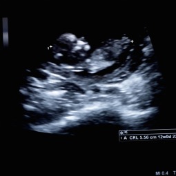 SEEING IS BELIEVING. A physician administers an ultrasound in a doctor's office in Montour Falls, N.Y.
SEEING IS BELIEVING. A physician administers an ultrasound in a doctor's office in Montour Falls, N.Y.