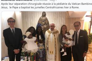 ‘After their successful surgical separation at Vatican Pediatrics Bambino Jesus, the Pope baptized the Central African twins yesterday in Rome,’ wrote politician Antoinette Montaigne on Twitter, where she posted the above photo.
‘After their successful surgical separation at Vatican Pediatrics Bambino Jesus, the Pope baptized the Central African twins yesterday in Rome,’ wrote politician Antoinette Montaigne on Twitter, where she posted the above photo.