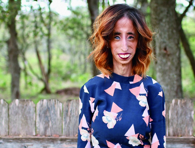 ‘Be truly and authentically yourself,’ says motivational speaker Lizzie Velasquez. ‘Be truly and authentically yourself,’ says motivational speaker Lizzie Velasquez.
