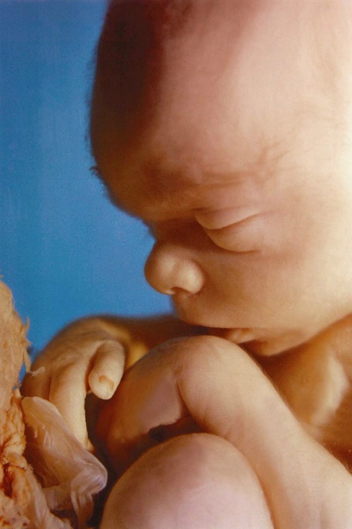 Twenty-week-old unborn child. Twenty-week-old unborn child.