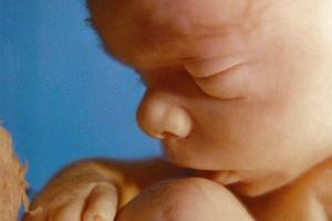 Twenty-week-old unborn child. Twenty-week-old unborn child.