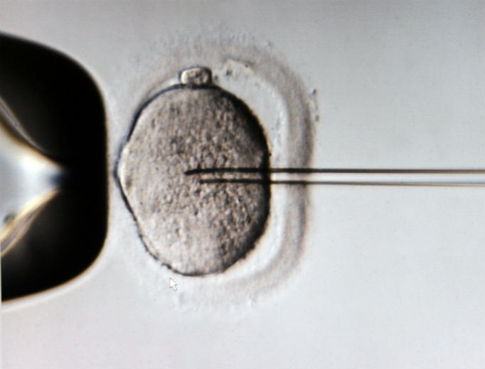 A monitor shows the microinjection of sperm into an egg cell using a microscope at the Kinderwunschzentrum in vitro fertilization clinic, in Leipzig, Germany. A monitor shows the microinjection of sperm into an egg cell using a microscope at the Kinderwunschzentrum in vitro fertilization clinic, in Leipzig, Germany.