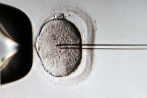 A monitor shows the microinjection of sperm into an egg cell using a microscope at the Kinderwunschzentrum in vitro fertilization clinic, in Leipzig, Germany. A monitor shows the microinjection of sperm into an egg cell using a microscope at the Kinderwunschzentrum in vitro fertilization clinic, in Leipzig, Germany.
