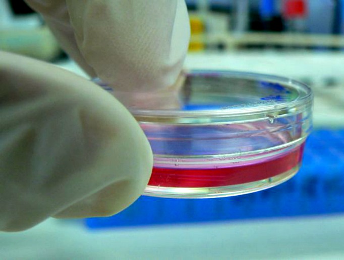 A scientist holds a petri dish. A scientist holds a petri dish.