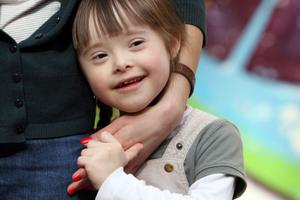 Young girl with Down syndrome. Young girl with Down syndrome.