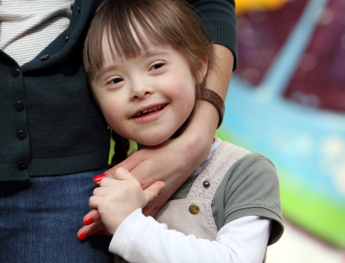 Young girl with Down syndrome. Young girl with Down syndrome.