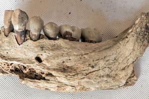 The jaw and teeth of St. Eanswythe. The jaw and teeth of St. Eanswythe.