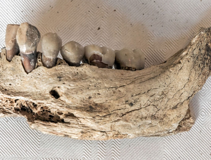 The jaw and teeth of St. Eanswythe. The jaw and teeth of St. Eanswythe.