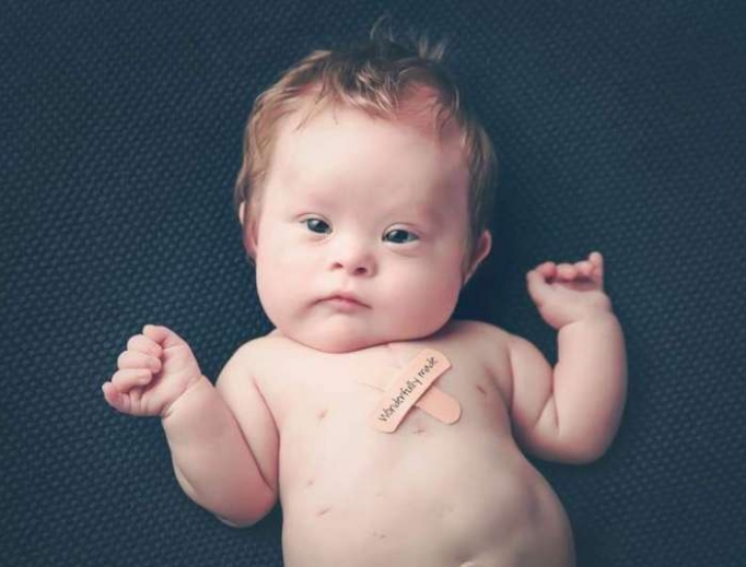 Mikey Schachle, whose life was saved by an officially recognized miracle through the intercession of Fr. Michael McGivney. Mikey Schachle, whose life was saved by an officially recognized miracle through the intercession of Fr. Michael McGivney.