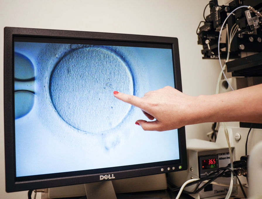An embryologist shows an image of an ovum at the Virginia Center for Reproductive Medicine in Reston, Virginia, on June 12, 2019. An embryologist shows an image of an ovum at the Virginia Center for Reproductive Medicine in Reston, Virginia, on June 12, 2019.
