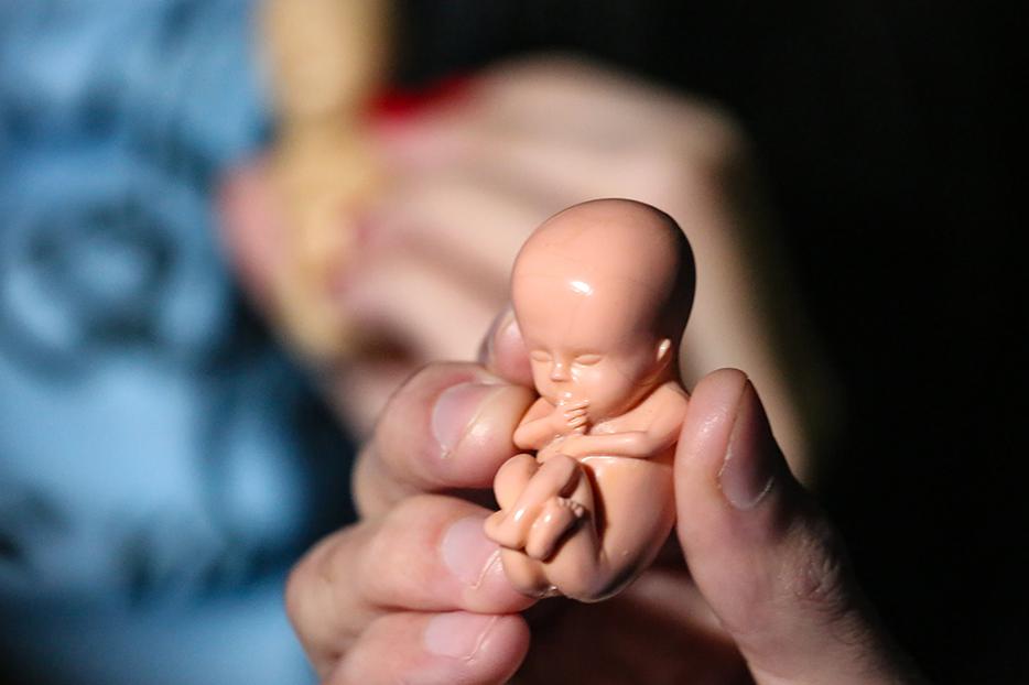 Pro-life activists demonstrate against the legalization of abortion in Olivos, Argentina, on July 30, 2018. Pro-life activists demonstrate against the legalization of abortion in Olivos, Argentina, on July 30, 2018.