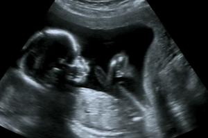 An ultrasound of a baby is shown during the third trimester. The USCCB emphasized Jan. 22 that Church teaching holds unborn life as sacred. An ultrasound of a baby is shown during the third trimester. The USCCB emphasized Jan. 22 that Church teaching holds unborn life as sacred.