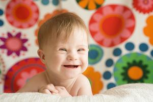 Cheerful baby girl with Down syndrome. Cheerful baby girl with Down syndrome.