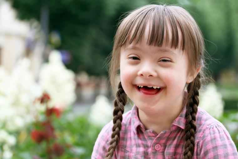 A young girl with Down syndrome. A young girl with Down syndrome.