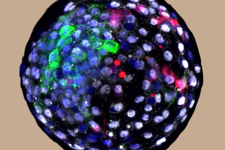 A human-monkey chimeric blastocyst. Credit: Weizhi Ji/Kunming University of Science and Technology. A human-monkey chimeric blastocyst. Credit: Weizhi Ji/Kunming University of Science and Technology.