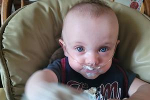 Baby Richard celebrates his first birthday after being born at 11 ounces. Baby Richard celebrates his first birthday after being born at 11 ounces.
