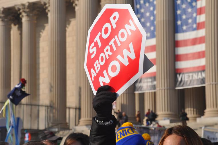 The Texas Heartbeat Act bans abortion after 6-weeks once a fetal heartbeat is recognized. The Texas Heartbeat Act bans abortion after 6-weeks once a fetal heartbeat is recognized.