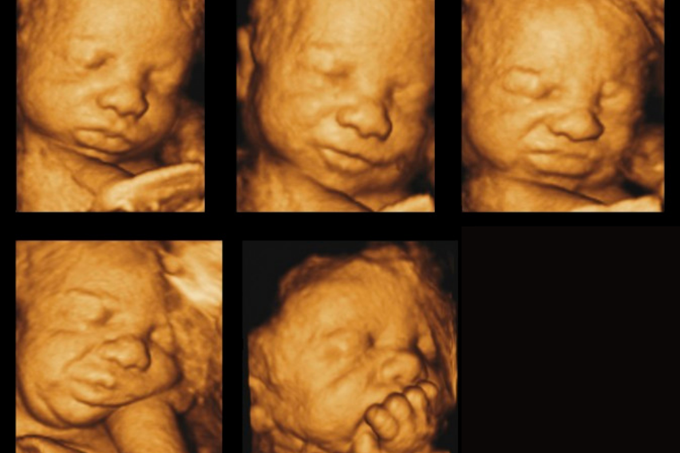 Offering remarkable details surrounding the science of babies in the womb from some of the leading names in neonatal care and maternal health, the brief also addresses euphemisms like “reproductive health” and “women’s choice” used today to protect society from the dark realities of abortion. Offering remarkable details surrounding the science of babies in the womb from some of the leading names in neonatal care and maternal health, the brief also addresses euphemisms like “reproductive health” and “women’s choice” used today to protect society from the dark realities of abortion.