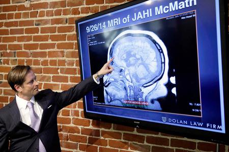 Attorney Christopher Dolan points to an MRI of Jahi McMath during an Oct. 3, 2014, news conference on the teen’s case, at his law office in San Francisco. Attorney Christopher Dolan points to an MRI of Jahi McMath during an Oct. 3, 2014, news conference on the teen’s case, at his law office in San Francisco.