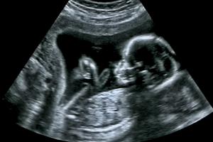 Biden’s declaration that he does not believe life begins at conception is contrary to what he had stated in the past. Biden’s declaration that he does not believe life begins at conception is contrary to what he had stated in the past.