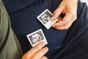 Sonogram images Sonogram images