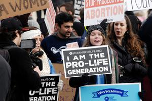 Instead of separating the well-being of a mother and an unborn child, 81% of Americans believe laws can protect both mother and baby. Instead of separating the well-being of a mother and an unborn child, 81% of Americans believe laws can protect both mother and baby.