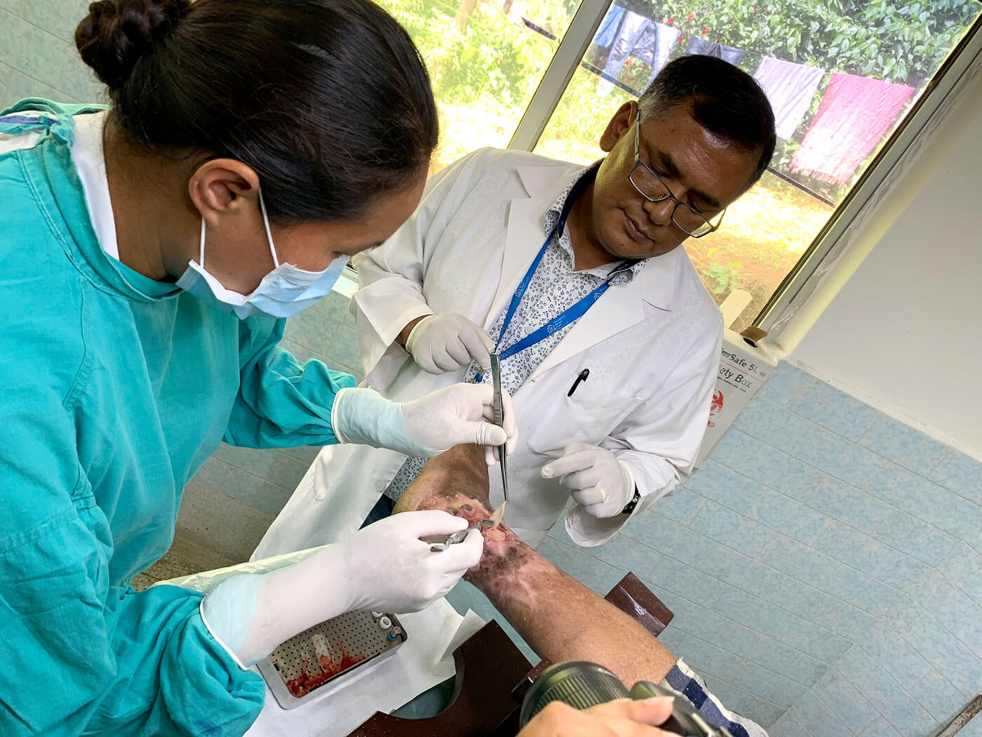 New treatment offers hope for Nepal’s leprosy patients