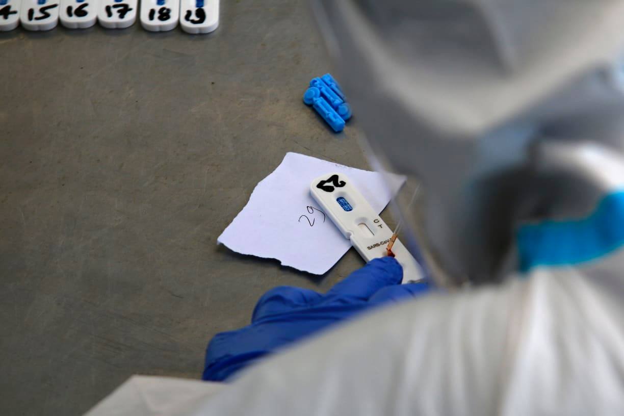 How COVID-19 puts us to the test