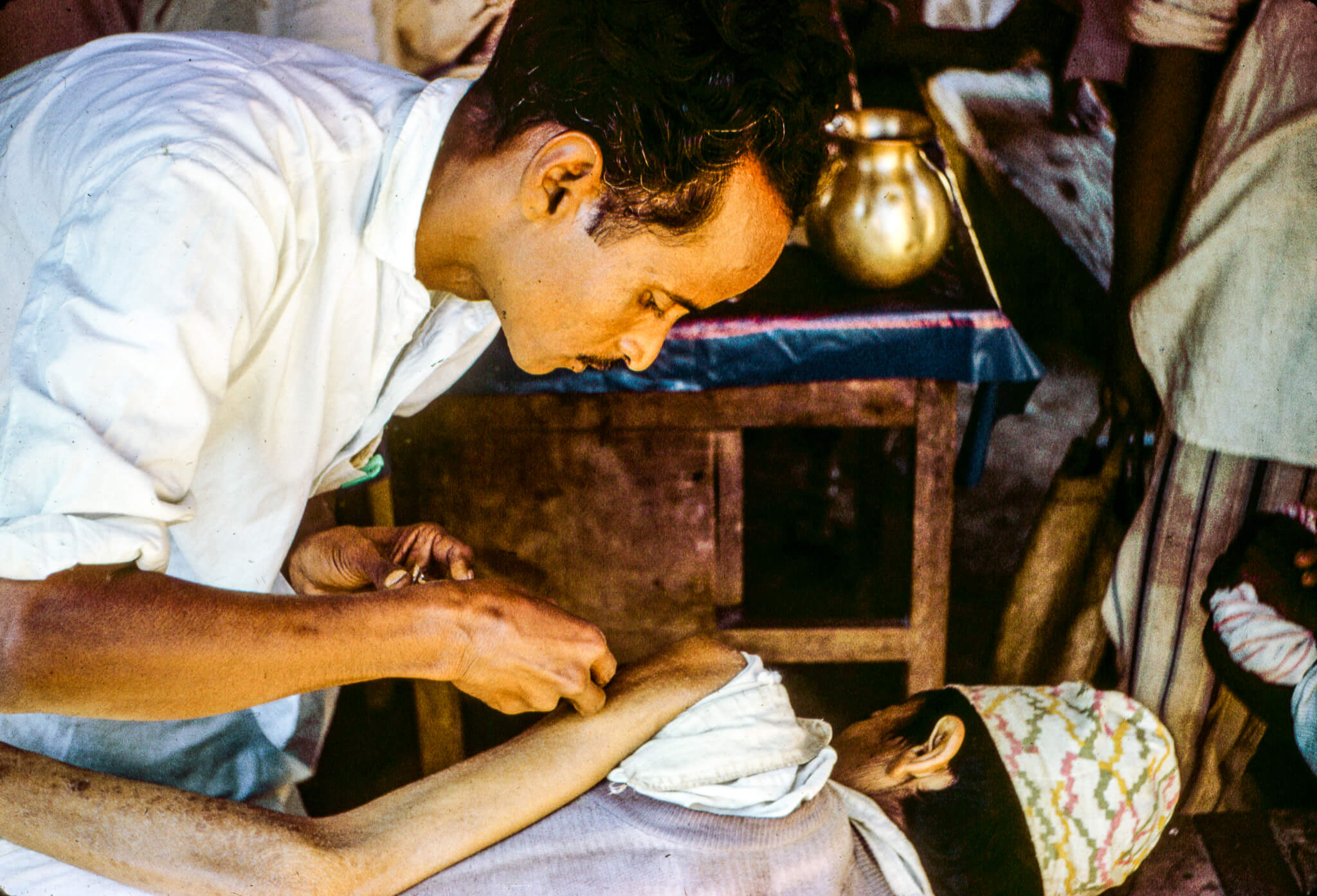 Big story of small pox in Nepal