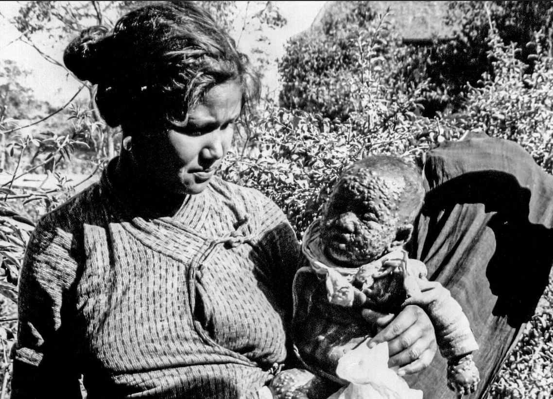 Smallpox, politics and power in Kathmandu