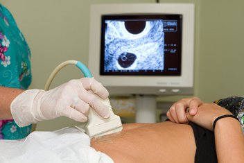 trudnoća, abortus