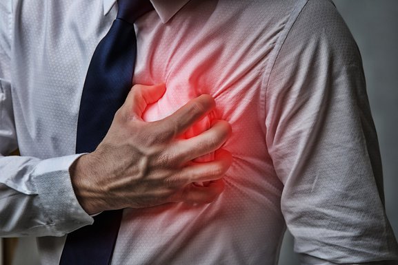 infarkt