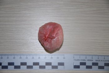 heroin