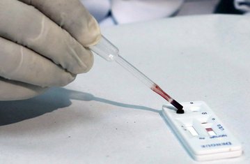 laboratorija, Zika virus