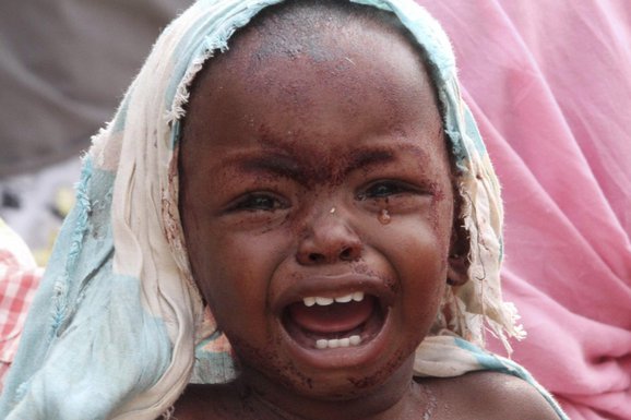 Somalija , glad