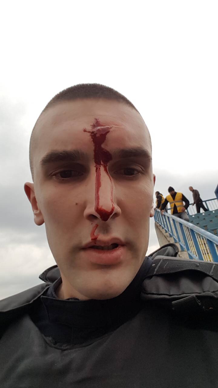 Povrijeđeni policajac Kerim Topuzović