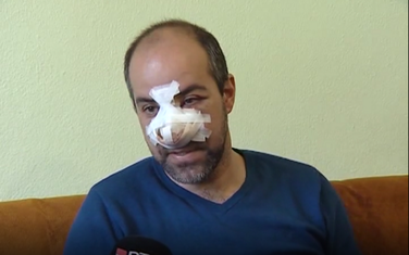 Igor Tomkić nakon prebijanja