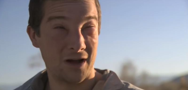 Grils 2008, kada je saznao da je alergičan