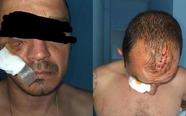 Povrede koje je Ivanović zadobio od policijskih službenika